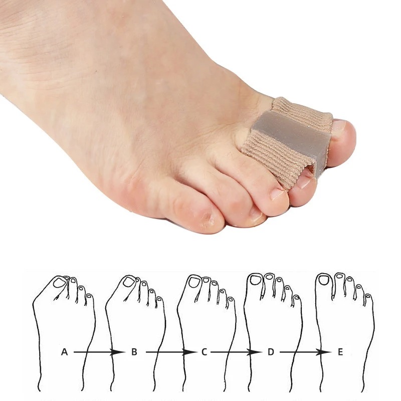 4PC 실리콘 발가락 분리기 손가락 발 관리 보호대 젤 - Yoga Toe Separator 리뷰 및 가격
