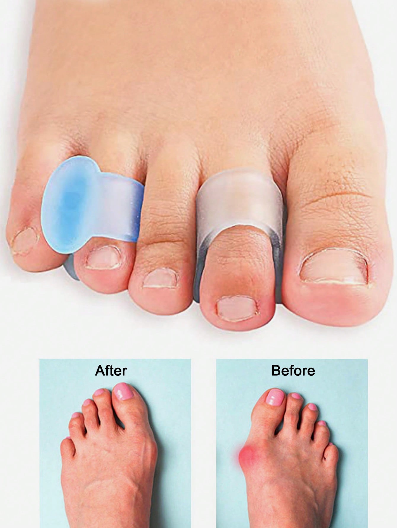 젤 발가락 분리기, 4개입 실리콘 발가락 스페이서(버니 - Yoga Toe Separator 리뷰 및 가격